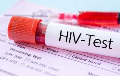 HIV