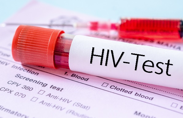 HIV